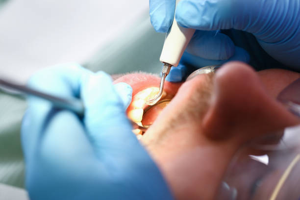 Best Pediatric Emergency Dentist in Twin Lakes, CO